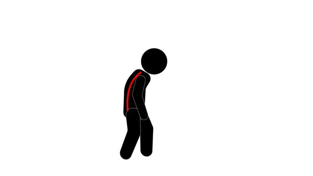 man walks with wrong posture. aligns and goes with correct posture. flat design. video illustration.