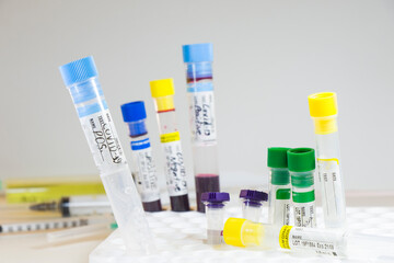 Corona virus, NCOV and Covid - 19 positive test samples. Blood tube samples.