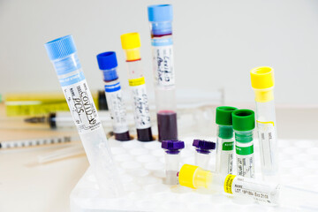 Corona virus, NCOV and Covid - 19 positive test samples. Blood tube samples.