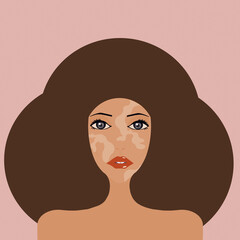
vitiligo woman portrait, brunette beauty, pink background