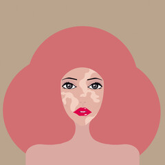 
vitiligo woman portrait, pink hair, beige background