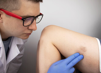 The vascular surgeon examines the outer thigh where the varicose veins are present. Preparation for...