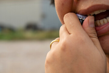 Use teeth to open the beer for speed. Requires a lot of tooth strength.