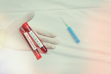 Handwriting text writing Influenza. Conceptual photo any of various respiratory infections of...