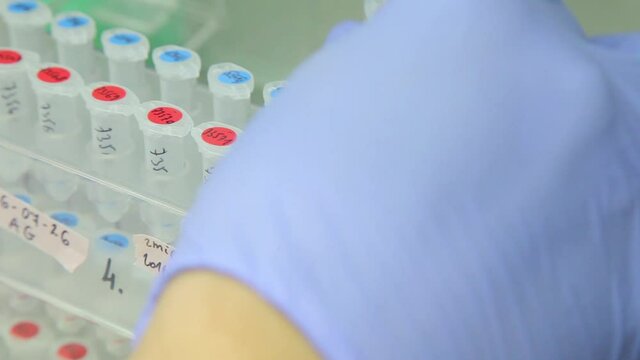 Testing Variety of substances in Laboratory
using pipette. DNA Test in a lab wearing nitrile Gloves