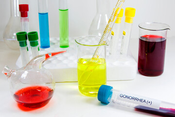 Gonorrhea blood test tube positive sample, laboratory diagnoses and chemical elements