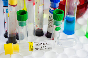 H1N1 swine influenza, diagnoses and lab tests, blood test tube samples, text and letter. © taidundua