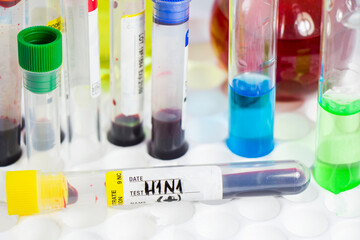 H1N1 swine influenza, diagnoses and lab tests, blood test tube samples, text and letter.