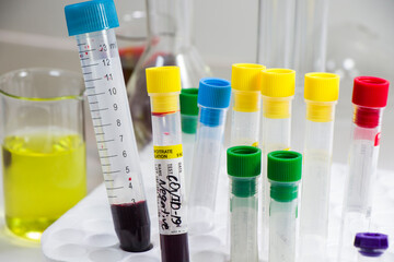 Corona virus, NCOV and Covid - 19 positive test samples. Blood tube samples. Diagnoses and laboratory research. Chemical elements.