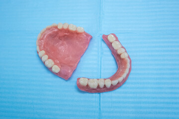 Removable dentures flexible, devoid of nylon, hypoallergenic exempt from monomer.