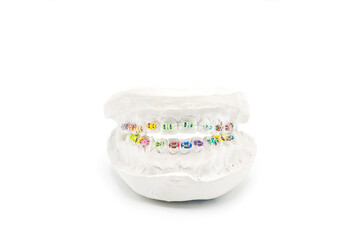 Close-up individual tooth tray Orthodontic dental theme.