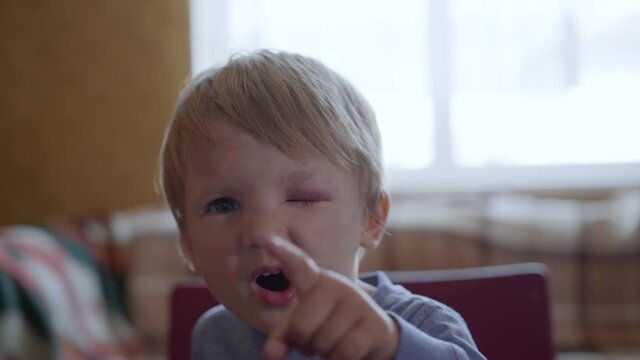 parenthood, small sad child with extravasation and bruise in eyes of child in dangerous situations during dangerous children games