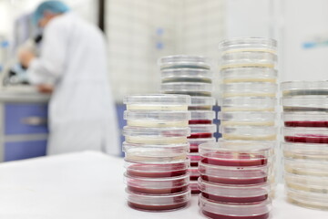 Selective focus of stack of petri dish with blurred male scientist working on a microscope on a...