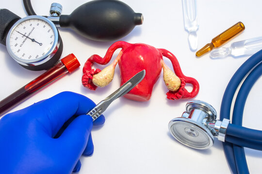 Concept Photo Of Uterus Surgery, Operation Of Uterus Resection Or Hysterectomy. Doctor With Scalpel In Hand Makes Incision In Figure Of Female Organ, Which Located Near Medical Toolkit - Stethoscope