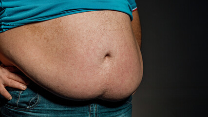 Overweight of a person's body with hands touching the abdomen. The concept of obesity