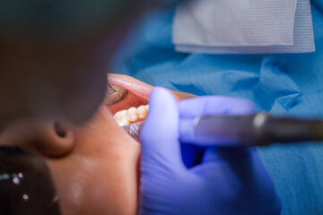 Asian female patient on dentist appointment during dental procedure. Human mouth open close up....