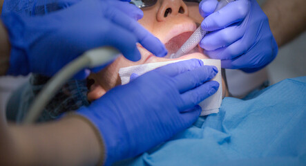 Asian female patient on dentist appointment during dental procedure. Human mouth open close up. Spot light in a face. Dentist makes initial examination, cleaning teeths and oral cavity of the patient.