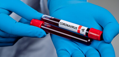Coronavirus 2019-nCoV Blood Sample.