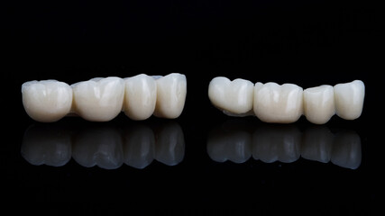 temporary dental bridges for chewing teeth made of medical polymer