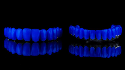 wax up on a titanium bar with blue wax teeth of the lower and upper jaws on black glass with a beautiful reflection © Dental Pro Content