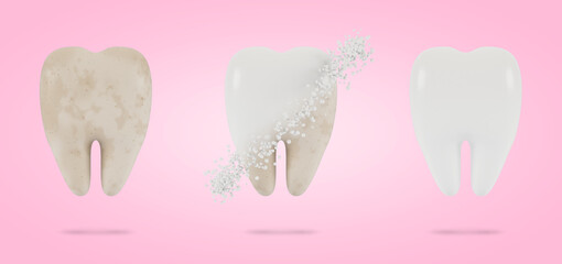 Tooth whitening. The concept of dental examination of teeth, dental health and hygiene. 3D illustration.