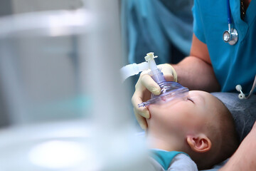 Preparation for dental surgery to remove multiple caries. Treatment of baby teeth. General anesthesia. The device of artificial ventilation of lungs.Copy of the space. - obrazy, fototapety, plakaty