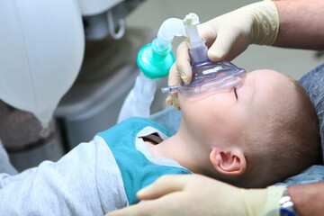 The child is under General anesthesia. Treatment of baby teeth.The device of artificial ventilation...