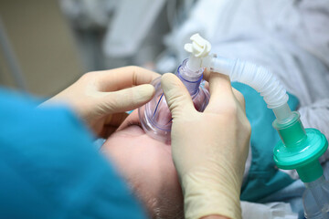 The anaesthetist holds a breathing mask on the child's face.Preparation for dental surgery. General...