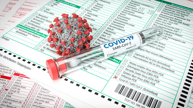 Covid-19 Virus mit Abstrich-Teströhrchen auf medizinischen Testformularen