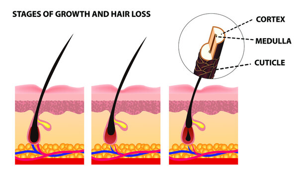 Hair Growth Cycle Images – Browse 661 Stock Photos, Vectors, and Video | Adobe Stock Hair Growth Cycle Images – Browse 661 Stock Photos, Vectors, and Video | Adobe Stock