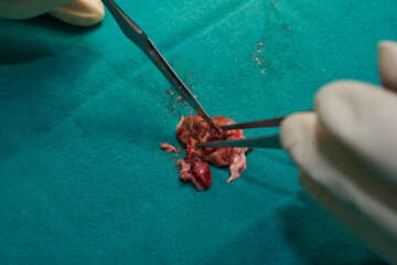 Doctor cutting brain specimen on operating table