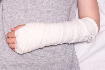 A child broken arm in plaster case, hand injury because of accident, forearm bones fracture
