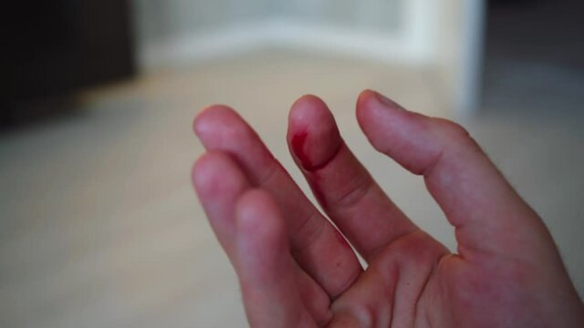 man's finger is covered in blood.