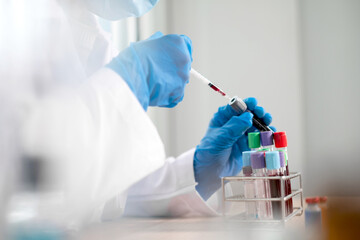 Professional doctors perform find virus tests from samples of blood tests to diagnose coronary...