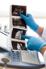Lekarz ginekolog trzyma w ręku zdjęcie usg. Klinika ginekologiczna.  - obrazy, fototapety, plakaty