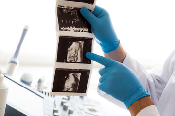 Lekarz ginekolog trzyma w ręku zdjęcie usg. Klinika ginekologiczna.  - obrazy, fototapety, plakaty