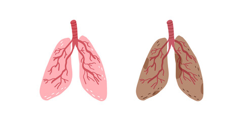Healthy lungs and lungs affected by illness or smoking or vaping. Vector illustration.