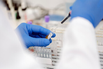 Scientist taking sample of blood from tube
