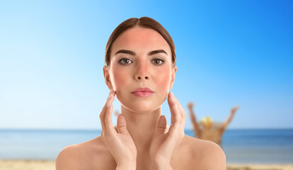 Woman with sunburn on beach. Skin protection from sun in summer
