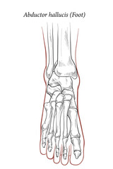 Medical illustration of Abductor hallucis muscle foot.