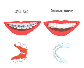 Two human mouth with dental braces and orthodontic transparent retainers on teeth. Choice between them. Oral care,bite correction. Beautiful straight  smile. Vector flat illustration for clinic