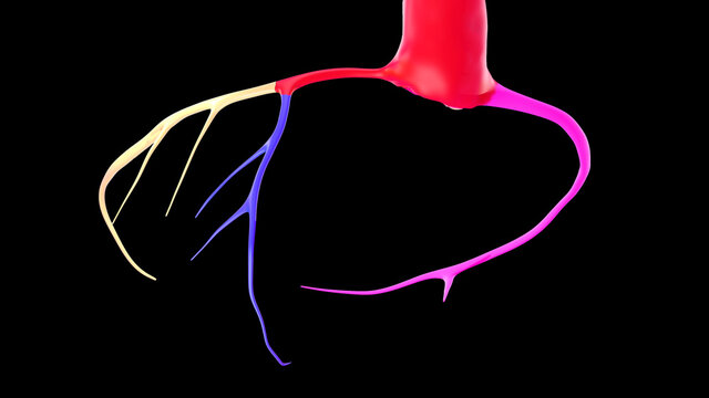 CTA Coronary artery  3D rendering 7.2020