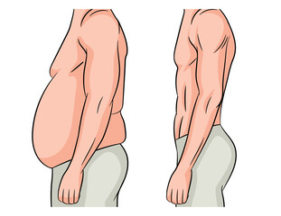 Color vector illustration isolated on white background. Man before and after losing weight. Male body transformation. The man lost extra pounds and lost weight at the waist.