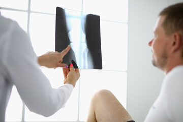 Doctor shows an x-ray of leg to patient. Medical trauma care concept