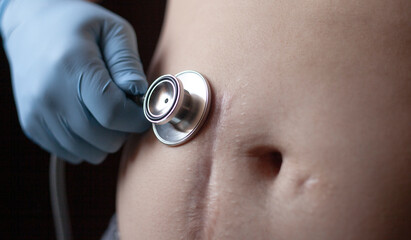 Fototapeta premium Stethoscope and scar on human skin