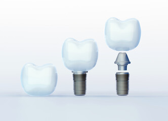 Tooth Сrown and Tooth Implants on white background, artificial tooth, 3d render