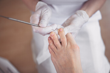 Obraz na płótnie Canvas Professional medical pedicure procedure close up using double nail instrument. Patient visiting chiropodist podiatrist. Foot treatment in SPA salon. Podiatry clinic. Pedicurist hands in white gloves.