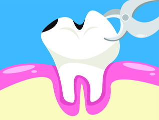 Bad tooth extraction with forceps.