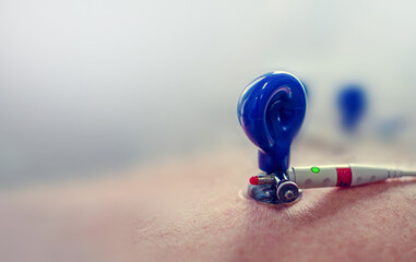 Vacuumed Cardiology Tool Placed on Skin With Blurred Background