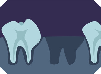 X-ray of the oral cavity with a missing tooth in the dentition. Medical concept. Flat vector illustration.